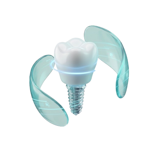 Dental Implants in Hadapsar: Step-by-Step Guide | Glaze Dental